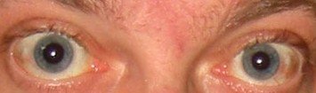Your Eyes can pop out!